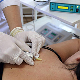 Карбокситерапия